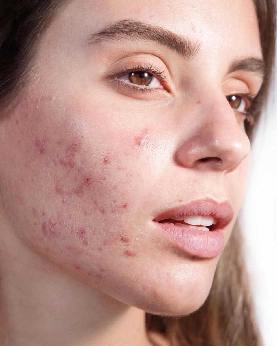 Улучшение фото